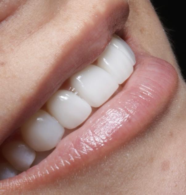 sonrisa